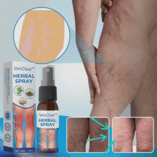 Elyra™ Varicose Veins Removal Spray